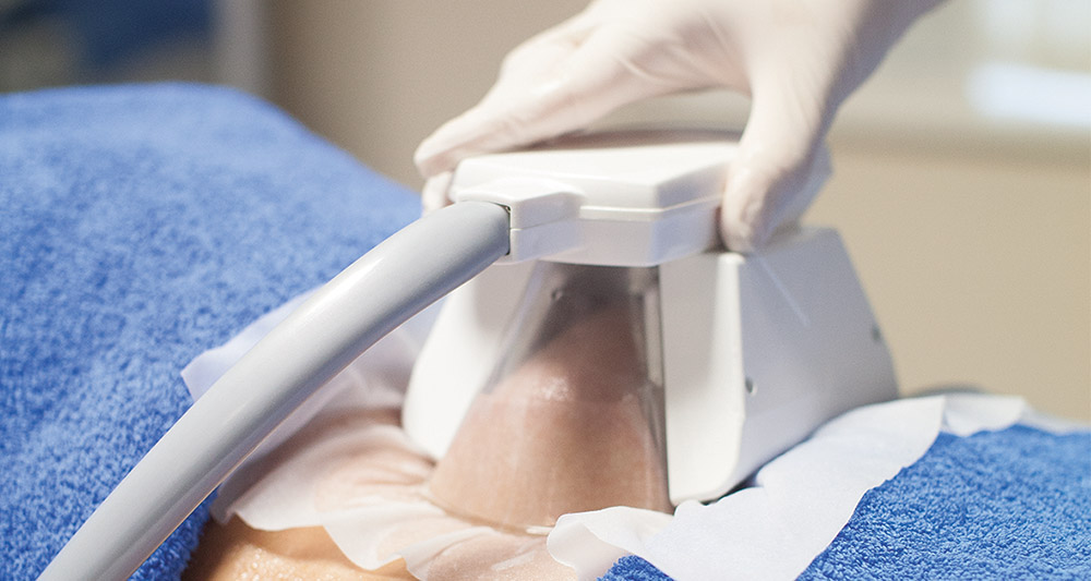 Multiple Areas in One Session HIFU and Fat Freezing Witley