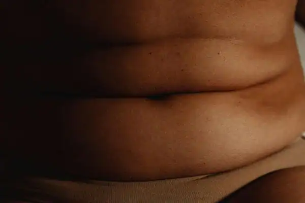 The Hidden Connection: How Stress Shapes Your Fitness and Body Composition 3 image of what stress can do on the stomach area and how Lipo 360 Witley can help to change your body shape.