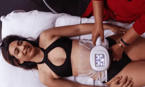 Woman having Body Sculpting treatment post injury Witley